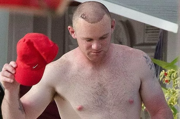 image-1-for-wayne-rooney-shows-of-his-new-hairline-while-on-hoilday-with-coleen-and-kai-gallery-447002343.jpg